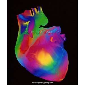 Human heart Framed Prints