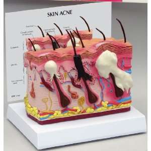  Acne Skin Cross Section Anatomical Model Beauty