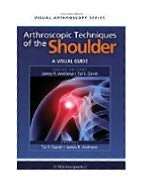 Arthroscopic Techniques of the Shoulder A Visual Guide, (1556428383 