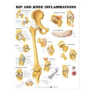 Hip Knee Inflammation Chart  Industrial & Scientific