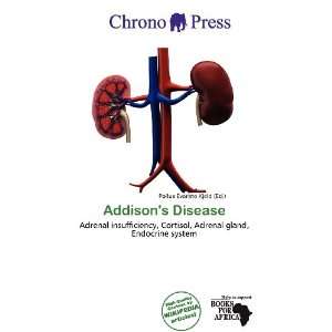  Addisons Disease (9786200587824) Pollux Évariste Kjeld 