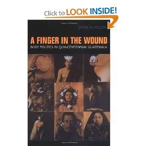  A Finger in the Wound Body Politics in Quincentennial 