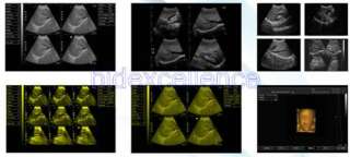   Digital Laptop Ultrasound Scanner/Machine 12.1 inch TFT color  