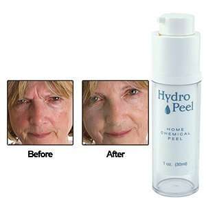  Hydro Peel Facial Cream